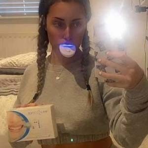 Teeth Whitening Kit Review - Molly